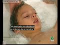 Paralisis Cerebral 1 de 3