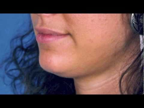 how to get rid neck fat