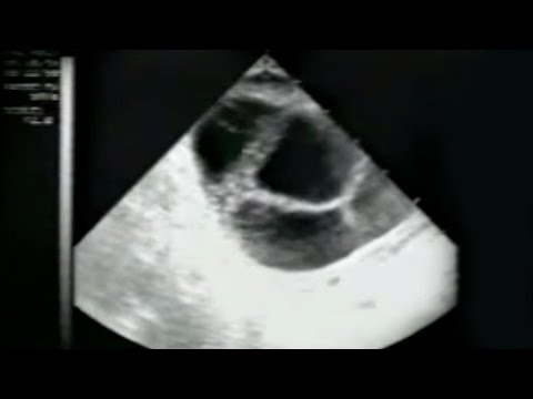 how to harvest ovum
