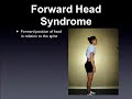 4 Conditions Responsible For Sciatica & Back Pain