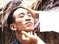 The Happy City - Leper Colony Documentary Educational Video Hansen's Disease