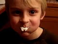 Rabies-Boy foaming at the mouth Rabies-Boy foaming at the mouth