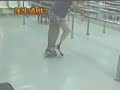 bk prosthetics