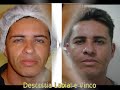 Medicina Est�tica.Pare! pode ser a solu��o de seus problemas