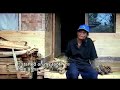 Tree Man 'who Grew Roots'