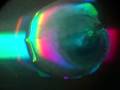 videos de Embryonic disc.MOV