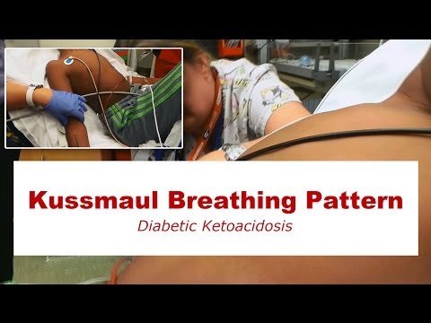how to treat kussmaul respirations