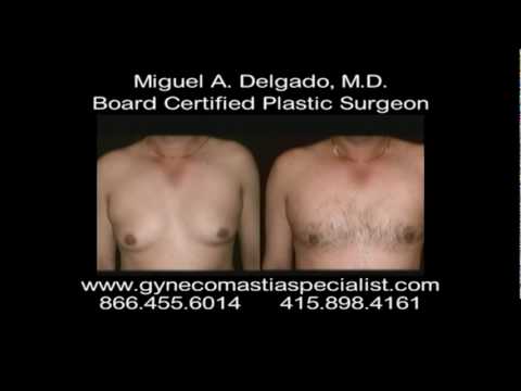 gynecomastia surgery before after. Gynecomastia-450 Before