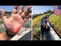 Seluncuran panas membakar kulit ayah dan anak - Tomonews