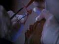 Nip/Tuck - s02e03 - Manya Mabika