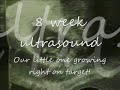 Our Pregnancy Journey
