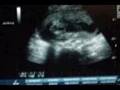 Lennon Fitzgerald Ultrasound