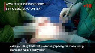 Gökhan Özerdem-52