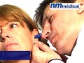 Heine Alpha Plus - Set otoscope à fibres optiques