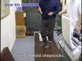 Outcomes of treatment for Parkinson's disease - Example 7