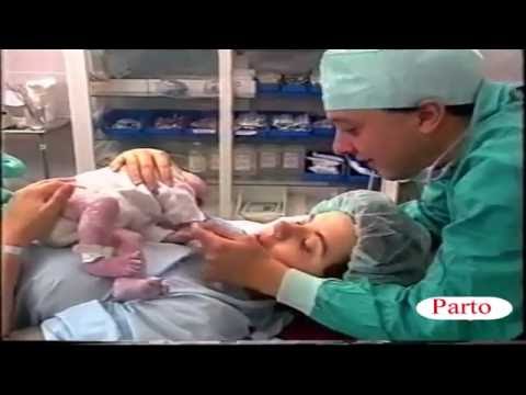 nacimiento o parto con ventosa, extracción placenta y episiotomía