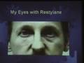 videos de Advances in Facial Rejuvenation - Non-Surgical Fillers