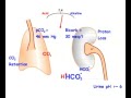 Metabolic alkalosis compensated