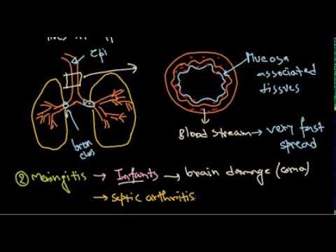 how to treat haemophilus influenzae type b