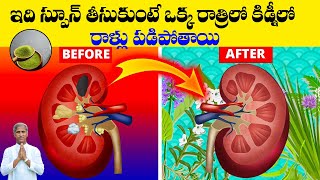 Kidney Stones | స్పూన్ తీసుకుంటే కిడ్నీ లో రాళ్లు కరిగిపోతాయి | Dr Manthena Satyanarayana Raju