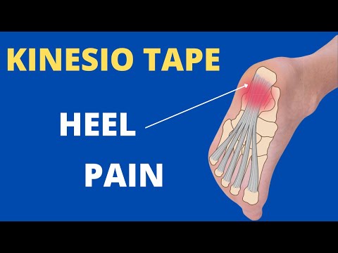 how to relieve plantar fasciitis pain