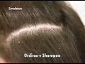 1993 Head and Shoulders Commercial