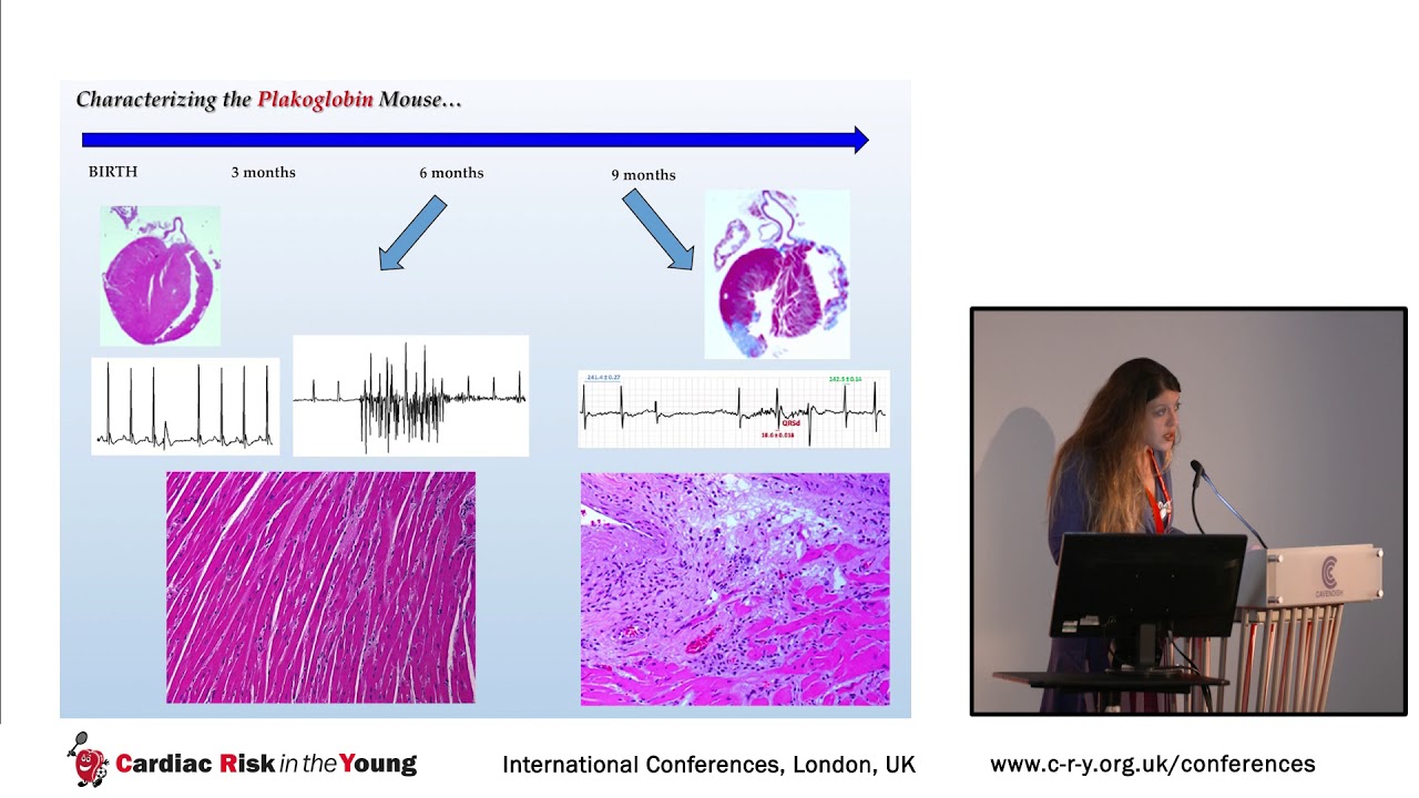 ARVC; Novel treatment options - Dr Angeliki Asimaki