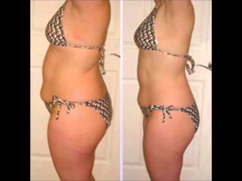 Acheter le fruit garcinia cambogia image 7