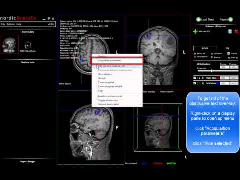 how to perform fmri