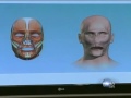 HARVARD FACE TRANSPLANT THE FACE TRANSPLANT USA