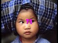 MAX BALDINO � YIJONG