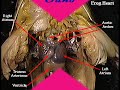 cardiovascular and lymphatic infections part 1