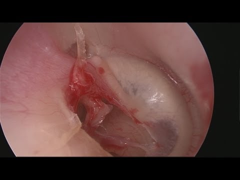 how to perform endoscopy