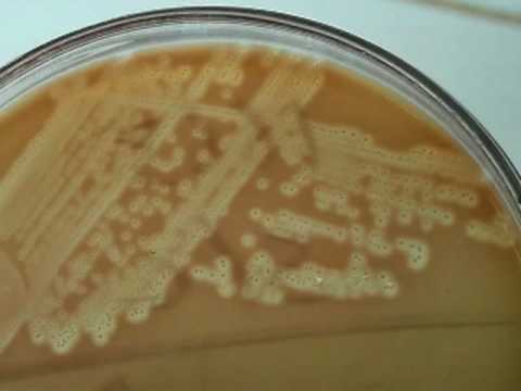 how to isolate streptococcus mutans