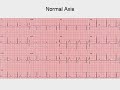 ECG Course 1