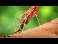 Insidermedicine in 60 - May 27, 2008  Prostate Diseases Prostate Infection