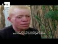 El drama de ser albino en Tanzania y Burundi