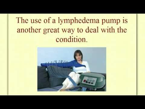 how to get rid of lymphedema