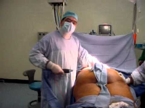 الشحوم - الدكتور كمال حسين صالح اختصاصي جراحة التجميل والتكميل مستشفى العمادي-دوحة -قطر Cosmetic surgery-mammoplasty-breast surgery-tummy tuck-hair transplantation-li...