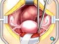 PreOp® Patient Education:  Hysterectomy Removal Uterus 1
