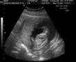 Ultra-sonografia - Renata Filgueiras - 16 Semanas