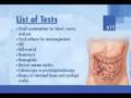 Inflammatory Bowel Disease
