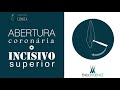 Anatomia e abertura coronária do Incisivo Superior