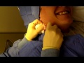 Hey check out my cyst chunks!