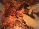 a group of new mexico students learn first hand what wellness and disease look like. they learn about the inner universe of the human body from a woman named 'judy' who donated her body to medical science.