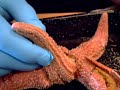 Starfish Dissection