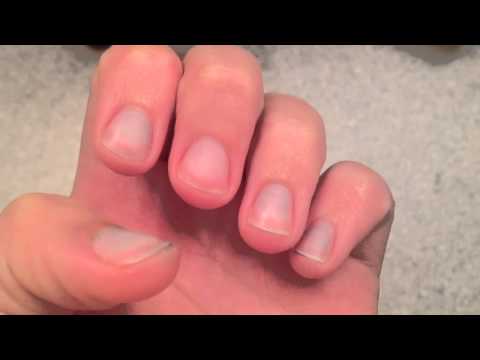 how to whiten stained nails