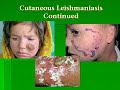 Leishmaniasis - RVerploegh08