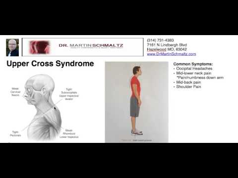 how to treat upper crossed syndrome