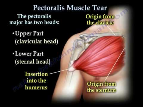 how to relieve pulled muscle in chest